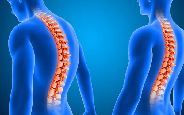 Degenerative Disc Disease: Causes, Symptoms and Treatment Methods